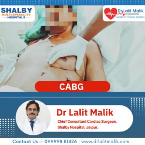Heart Surgery By Dr. Lalit Malik