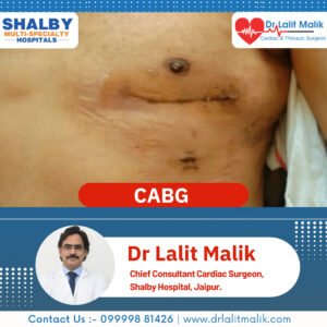 Successful Heart Surgery By Dr. Lalit Malik
